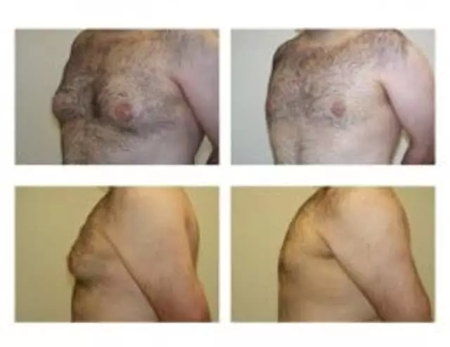 Andrew Barnett, MD