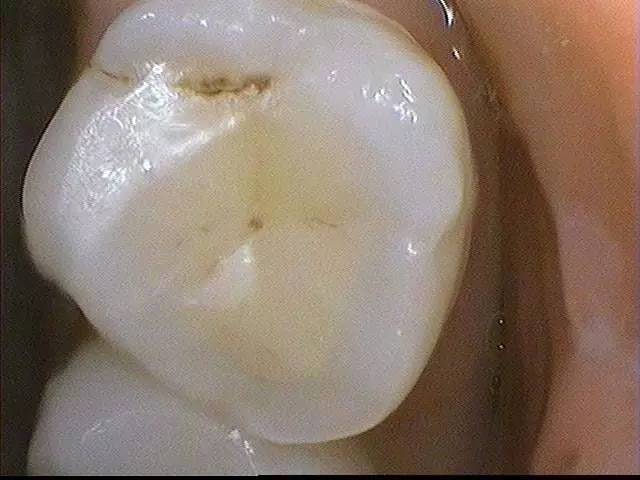 Advanced Dentistry Art of the Smile