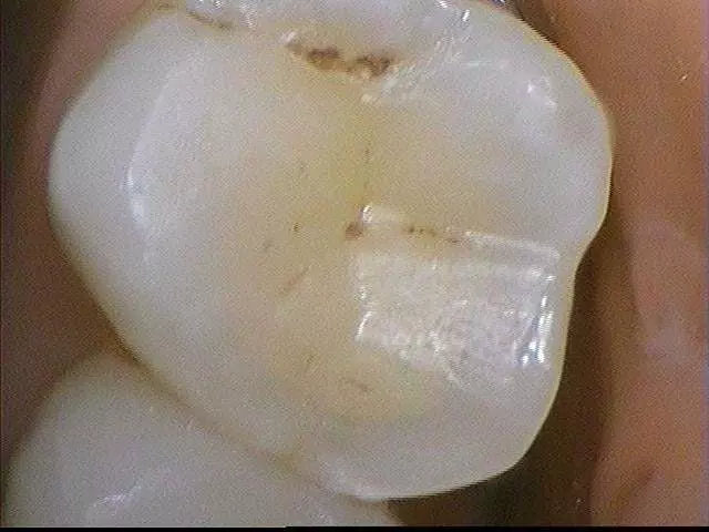 Advanced Dentistry Art of the Smile