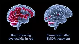 Xanthe Asher, MFT, EMDR