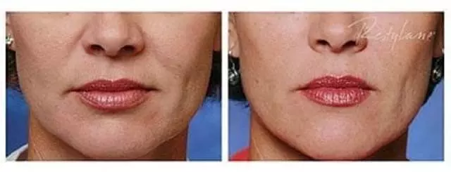 Ageless Beauty Skin Clinic