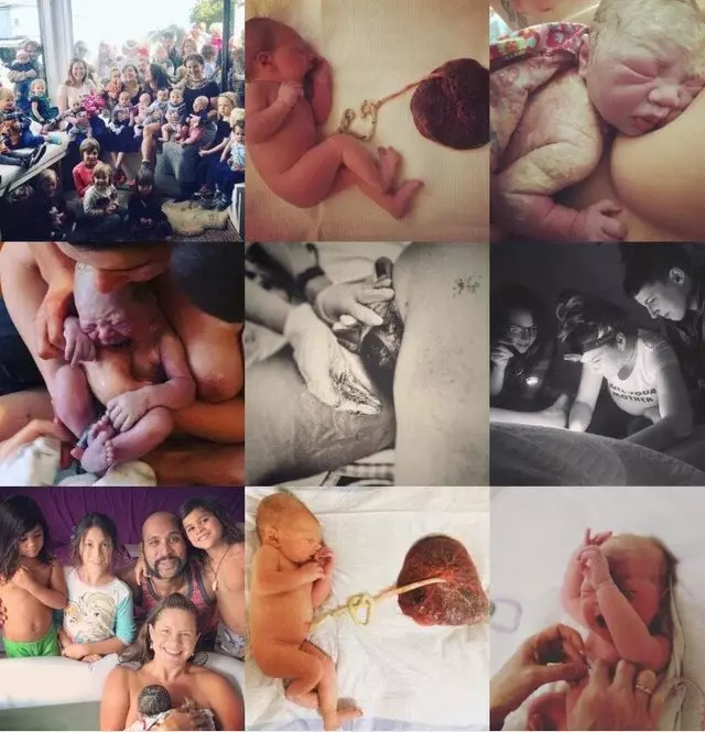 Mothercraft Midwifery
