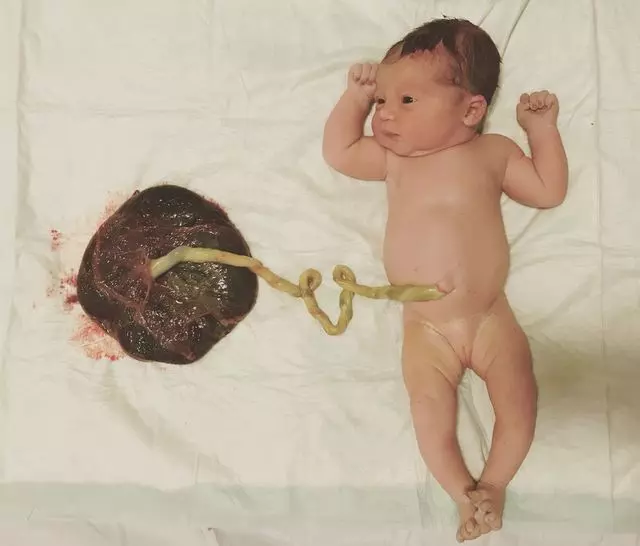 Mothercraft Midwifery
