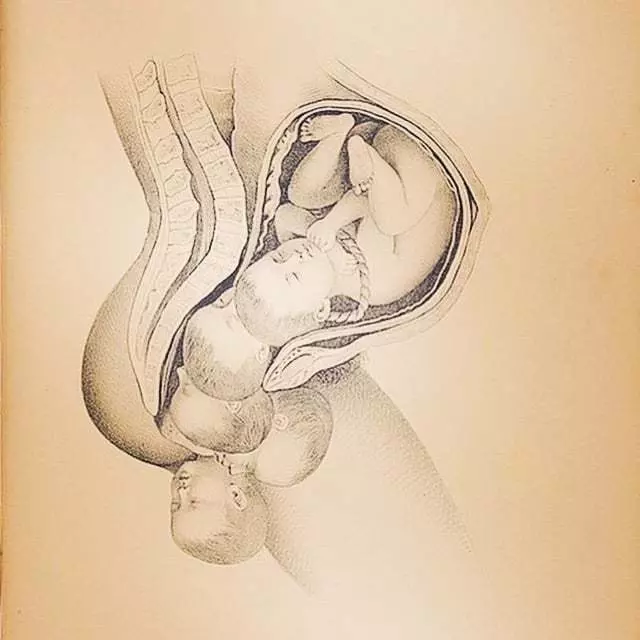Mothercraft Midwifery