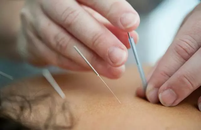 Bu Tong Acupuncture