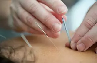 Bu Tong Acupuncture