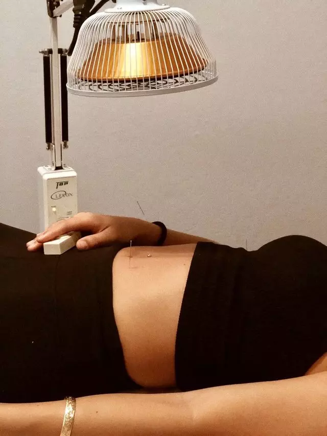 Stephanie Wu Acupuncture