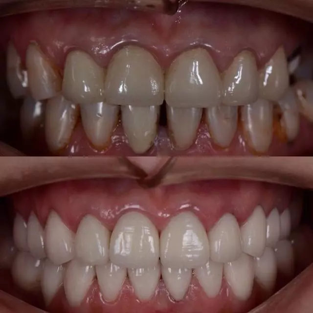 Albina Batchaeva, DDS - Dental Arts
